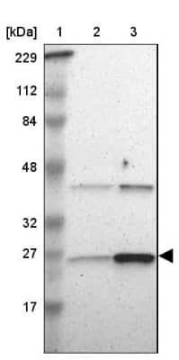 Western Blot: Adenylate Kinase 1 Antibody [NBP1-87401]