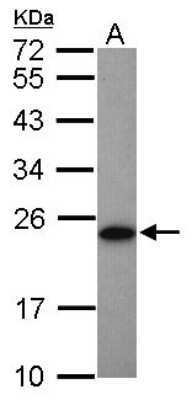 Western Blot: Adenylate Kinase 1 Antibody [NBP2-15295]