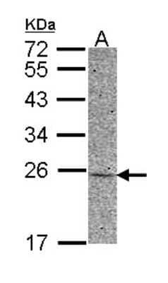 Western Blot: Adenylate Kinase 1 Antibody [NBP2-15295]