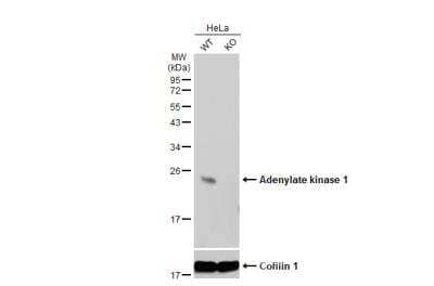 Western Blot: Adenylate Kinase 1 Antibody [NBP2-15295]