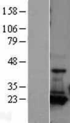 Western Blot: Adenylate Kinase 1 Overexpression Lysate [NBL1-07417]