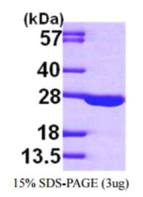 SDS-PAGE: Recombinant Human Adenylate Kinase 1 His Protein [NBP1-50855]