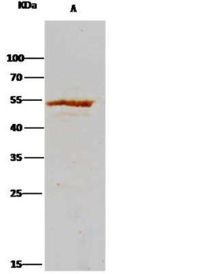 Immunoprecipitation: Adenylosuccinate Lyase Antibody (007) [NBP2-89878]