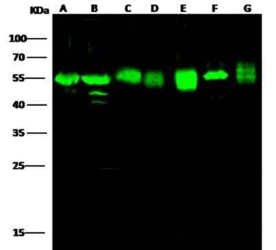 Western Blot: Adenylosuccinate Lyase Antibody (007) [NBP2-89878]