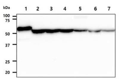 Western Blot: Adenylosuccinate Lyase Antibody (16C10)BSA Free [NBP2-59414]