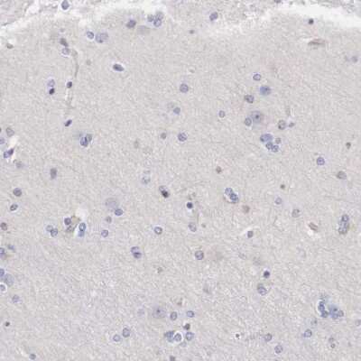 Immunohistochemistry-Paraffin: Adenylosuccinate Lyase Antibody [NBP1-87406]