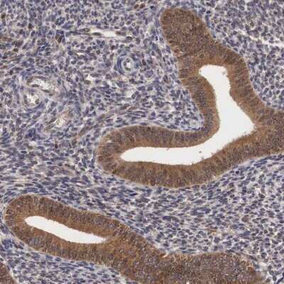 Immunohistochemistry-Paraffin: Adenylosuccinate Lyase Antibody [NBP1-87406]