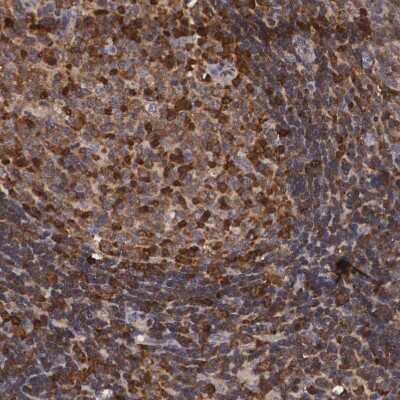 Immunohistochemistry-Paraffin: Adenylosuccinate Lyase Antibody [NBP1-87406]
