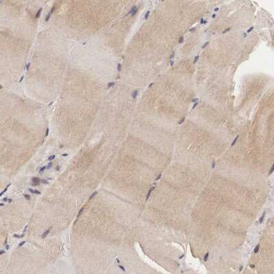Immunohistochemistry-Paraffin: Adenylosuccinate Lyase Antibody [NBP1-87406]