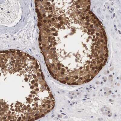 Immunohistochemistry-Paraffin: Adenylosuccinate Lyase Antibody [NBP1-87406]