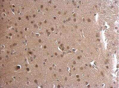 Immunohistochemistry-Paraffin: Adenylosuccinate Lyase Antibody [NBP2-15296]