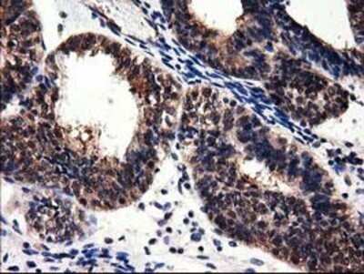 Immunohistochemistry: Adenylosuccinate Lyase Antibody (OTI2D10) - Azide and BSA Free [NBP2-70101]