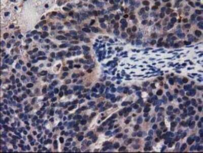 Immunohistochemistry: Adenylosuccinate Lyase Antibody (OTI2D10) - Azide and BSA Free [NBP2-70101]