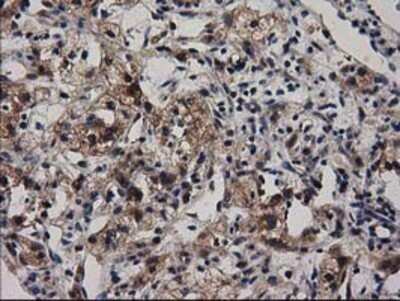 Immunohistochemistry: Adenylosuccinate Lyase Antibody (OTI2D10) - Azide and BSA Free [NBP2-70101]