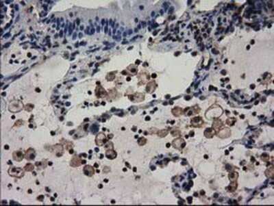 Immunohistochemistry: Adenylosuccinate Lyase Antibody (OTI2D10) - Azide and BSA Free [NBP2-70101]