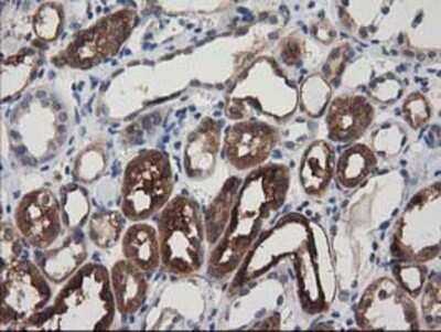 Immunohistochemistry: Adenylosuccinate Lyase Antibody (OTI2D10) - Azide and BSA Free [NBP2-70101]