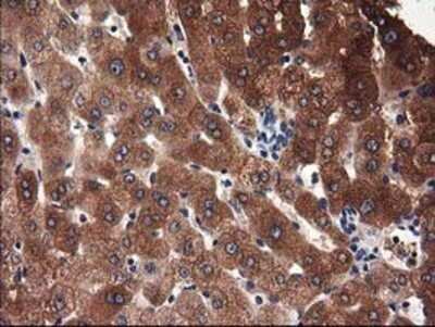 Immunohistochemistry: Adenylosuccinate Lyase Antibody (OTI2D10) - Azide and BSA Free [NBP2-70101]