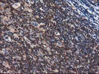 Immunohistochemistry: Adenylosuccinate Lyase Antibody (OTI2D10) - Azide and BSA Free [NBP2-70101]