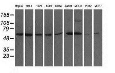 Western Blot: Adenylosuccinate Lyase Antibody (OTI2D10)Azide and BSA Free [NBP2-70101]
