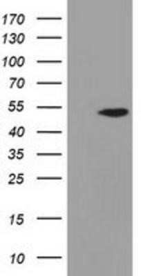 Western Blot: Adenylosuccinate Lyase Antibody (OTI2D10)Azide and BSA Free [NBP2-70101]