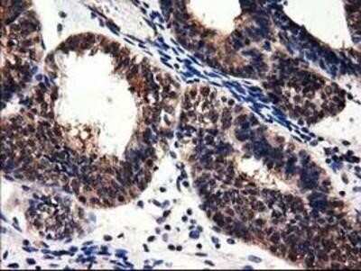 Immunohistochemistry-Paraffin: Adenylosuccinate Lyase Antibody (OTI2D10) [NBP2-03107]