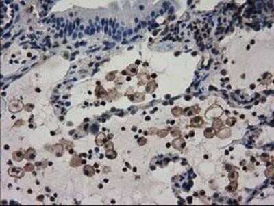 Immunohistochemistry-Paraffin: Adenylosuccinate Lyase Antibody (OTI2D10) [NBP2-03107]