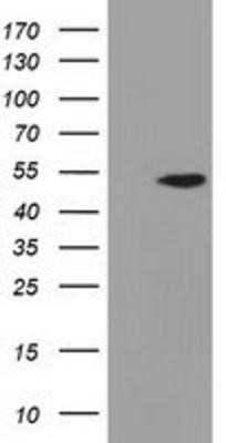 Western Blot: Adenylosuccinate Lyase Antibody (OTI2D10) [NBP2-03107]