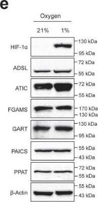 Western Blot: Adenylosuccinate Lyase Antibody (OTI2D10) [NBP2-03107]