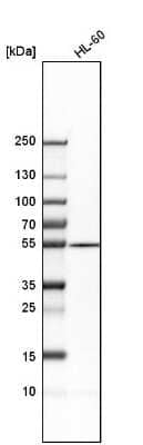Western Blot: Adenylosuccinate Lyase Antibody [NBP1-87406]