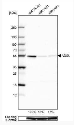 Western Blot: Adenylosuccinate Lyase Antibody [NBP1-87406]