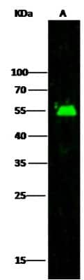 Western Blot: Adenylosuccinate Lyase Antibody [NBP2-99767]