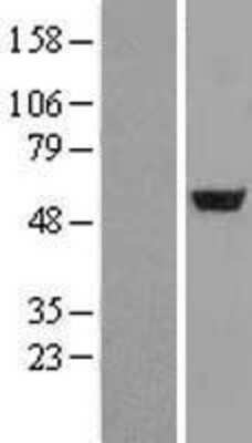 Western Blot: Adenylosuccinate Lyase Overexpression Lysate [NBL1-07363]