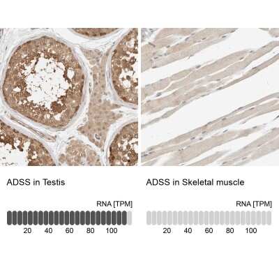 Immunohistochemistry-Paraffin: Adenylosuccinate Synthase Antibody [NBP1-90360]