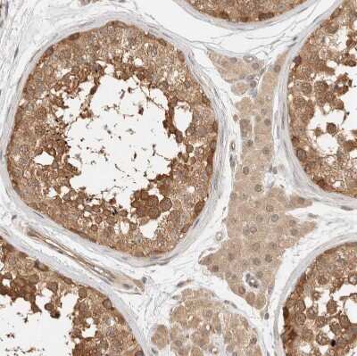 Immunohistochemistry-Paraffin: Adenylosuccinate Synthase Antibody [NBP1-90360]
