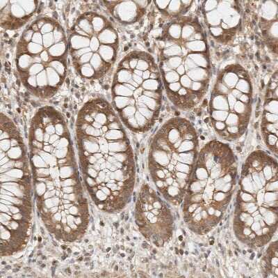 Immunohistochemistry-Paraffin: Adenylosuccinate Synthase Antibody [NBP1-90360]