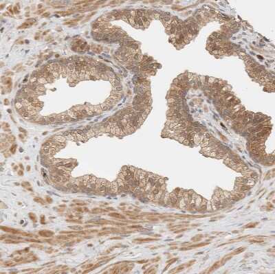 Immunohistochemistry-Paraffin: Adenylosuccinate Synthase Antibody [NBP1-90360]