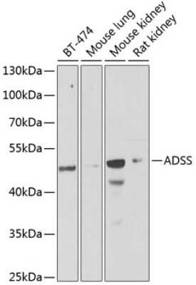 Western Blot: Adenylosuccinate Synthase AntibodyBSA Free [NBP2-92661]