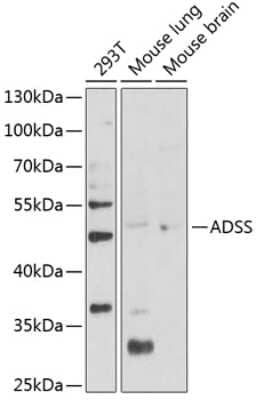 Western Blot: Adenylosuccinate Synthase AntibodyBSA Free [NBP2-92852]