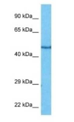 Western Blot: Adenylosuccinate Synthase Antibody [NBP3-10839]