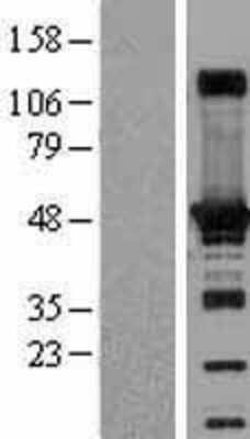 Western Blot: Adenylosuccinate Synthase Overexpression Lysate [NBL1-07364]