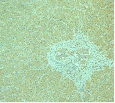 Immunohistochemistry: AdipoR1 Antibody [NBP1-28640]