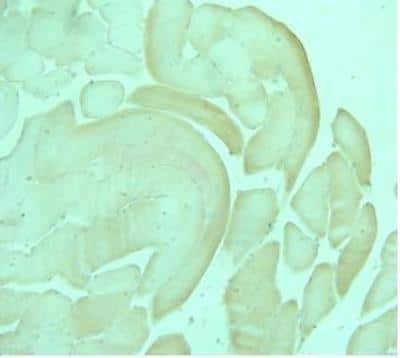 Immunohistochemistry: AdipoR1 Antibody [NBP1-28640]