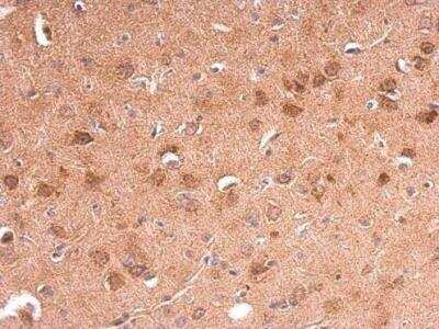 Immunohistochemistry-Paraffin: AdipoR1 Antibody [NBP2-15300]