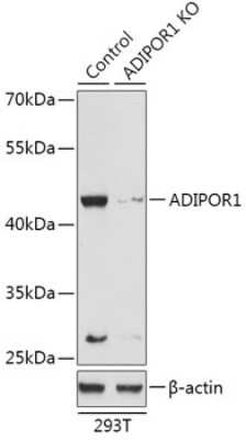 Knockout Validated: AdipoR1 Antibody - Azide and BSA Free [NBP3-03267]