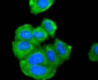 Immunocytochemistry/ Immunofluorescence: AdipoR1 Antibody (SC69-04) [NBP2-67631]