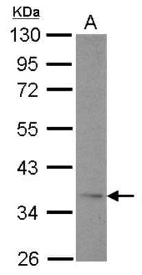 Western Blot: AdipoR1 Antibody [NBP2-15300]