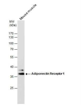 Western Blot: AdipoR1 Antibody [NBP2-15300]