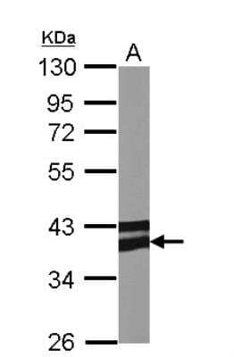 Western Blot: AdipoR1 Antibody [NBP2-15300]