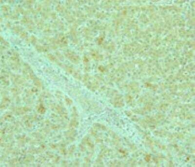 Immunohistochemistry-Paraffin: AdipoR2 Antibody [NBP1-28641]