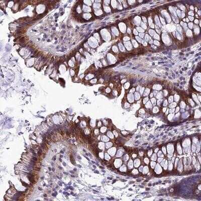 Immunohistochemistry-Paraffin: AdipoR2 Antibody [NBP1-91652]